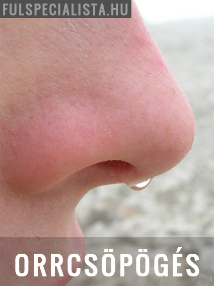 orrcsöpögés allergia szénanátha
