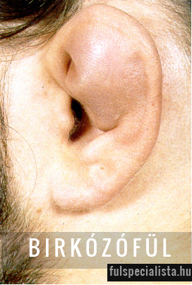 fülsérülés birkózófül karfiol fül